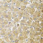 CEP164 Antibody in Immunohistochemistry (Paraffin) (IHC (P))