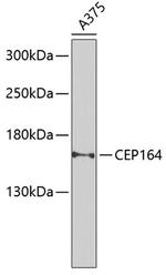 CEP164 Antibody in Western Blot (WB)