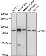 CEP63 Antibody in Western Blot (WB)