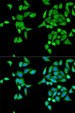 CES2 Antibody in Immunocytochemistry (ICC/IF)