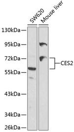 CES2 Antibody in Western Blot (WB)