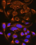 Properdin Antibody in Immunocytochemistry (ICC/IF)