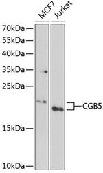 hCG beta-5 Antibody in Western Blot (WB)