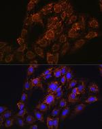 CHCHD2 Antibody in Immunocytochemistry (ICC/IF)