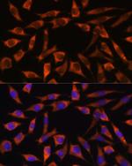 CHCHD2 Antibody in Immunocytochemistry (ICC/IF)