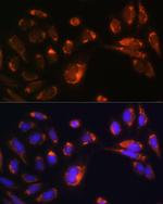 CHCHD2 Antibody in Immunocytochemistry (ICC/IF)