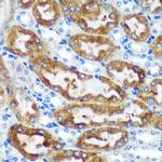 CHCHD2 Antibody in Immunohistochemistry (Paraffin) (IHC (P))