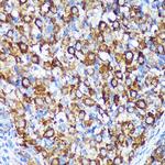 CHCHD2 Antibody in Immunohistochemistry (Paraffin) (IHC (P))