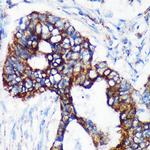 CHCHD2 Antibody in Immunohistochemistry (Paraffin) (IHC (P))