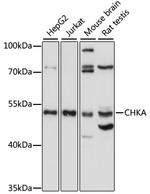 CHKA Antibody in Western Blot (WB)