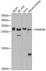CHMP2B Antibody in Western Blot (WB)