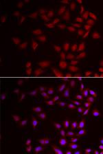 CIRBP Antibody in Immunocytochemistry (ICC/IF)