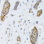 CIRBP Antibody in Immunohistochemistry (Paraffin) (IHC (P))