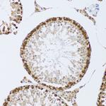 CIRBP Antibody in Immunohistochemistry (Paraffin) (IHC (P))