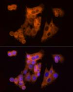 CLIC1 Antibody in Immunocytochemistry (ICC/IF)