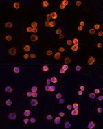 CLIC1 Antibody in Immunocytochemistry (ICC/IF)