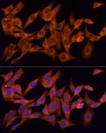 CLIC1 Antibody in Immunocytochemistry (ICC/IF)