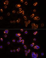 CLIC1 Antibody in Immunocytochemistry (ICC/IF)