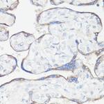 CLUH Antibody in Immunohistochemistry (Paraffin) (IHC (P))