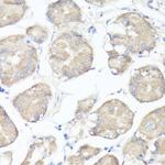 CLUH Antibody in Immunohistochemistry (Paraffin) (IHC (P))