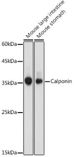 Calponin 1 Antibody in Western Blot (WB)