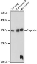 Calponin 1 Antibody in Western Blot (WB)