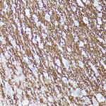 CNTN1 Antibody in Immunohistochemistry (Paraffin) (IHC (P))