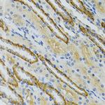 COG2 Antibody in Immunohistochemistry (Paraffin) (IHC (P))