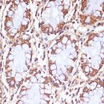 CPT1B Antibody in Immunohistochemistry (Paraffin) (IHC (P))