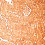 CPT1B Antibody in Immunohistochemistry (Paraffin) (IHC (P))