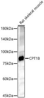 CPT1B Antibody in Western Blot (WB)