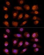 CRYGC Antibody in Immunocytochemistry (ICC/IF)