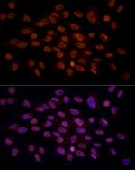 CRYGC Antibody in Immunocytochemistry (ICC/IF)