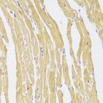 CSRP3 Antibody in Immunohistochemistry (Paraffin) (IHC (P))