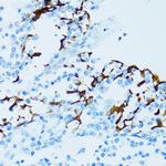 Cathepsin E Antibody in Immunohistochemistry (Paraffin) (IHC (P))