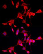 CYP4V2 Antibody in Immunocytochemistry (ICC/IF)