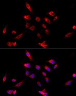 CYP4V2 Antibody in Immunocytochemistry (ICC/IF)