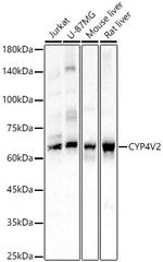 CYP4V2 Antibody in Western Blot (WB)