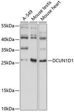 DCUN1D1 Antibody in Western Blot (WB)