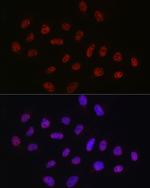 DDX39A Antibody in Immunocytochemistry (ICC/IF)