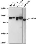 DDX56 Antibody in Western Blot (WB)