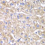 DLST Antibody in Immunohistochemistry (Paraffin) (IHC (P))