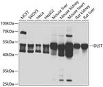 DLST Antibody in Western Blot (WB)