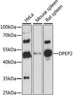 DPEP2 Antibody in Western Blot (WB)