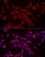 DUSP8 Antibody in Immunocytochemistry (ICC/IF)