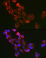 ECM1 Antibody in Immunocytochemistry (ICC/IF)
