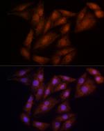 ECSIT Antibody in Immunocytochemistry (ICC/IF)