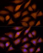 ECSIT Antibody in Immunocytochemistry (ICC/IF)