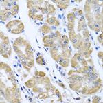 eIF2 gamma Antibody in Immunohistochemistry (Paraffin) (IHC (P))