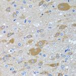 eIF2 gamma Antibody in Immunohistochemistry (Paraffin) (IHC (P))